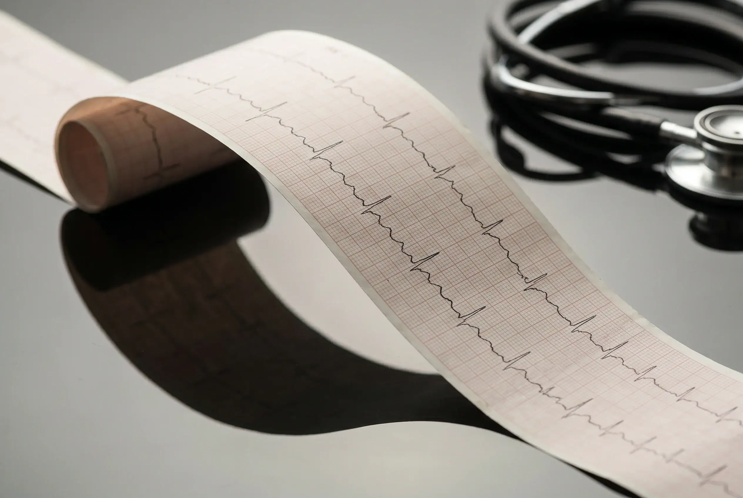 Uredan EKG nalaz na crnom stolu, tjelesni simptomi anksioznosti uz zdravo srce